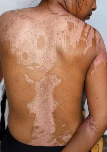 Fotógrafo de EL UNIVERSAL es reconocido con Premio Alemán de Periodismo Walter Reuter