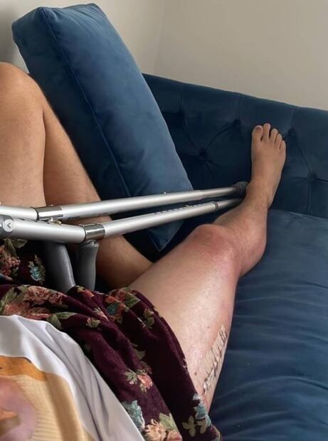 Kevin Parker, vocalista de Tame Impala, se fractura la cadera: ¿qué pasará con los conciertos en CDMX?