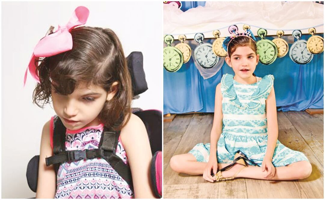 Imagen de la menor después del tratamiento derivado de la sustancia. (CORTESÍA)