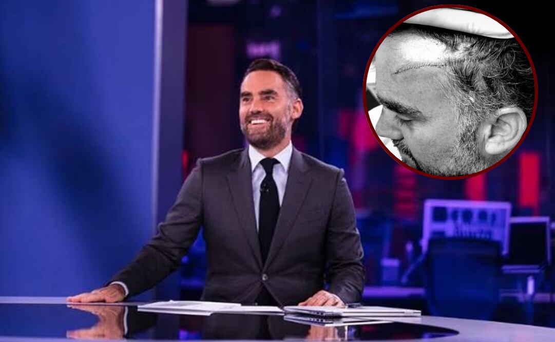 Enrique Acevedo, conductor de noticiero “En Punto”, revela que sufrió accidente. Foto: Redes sociales