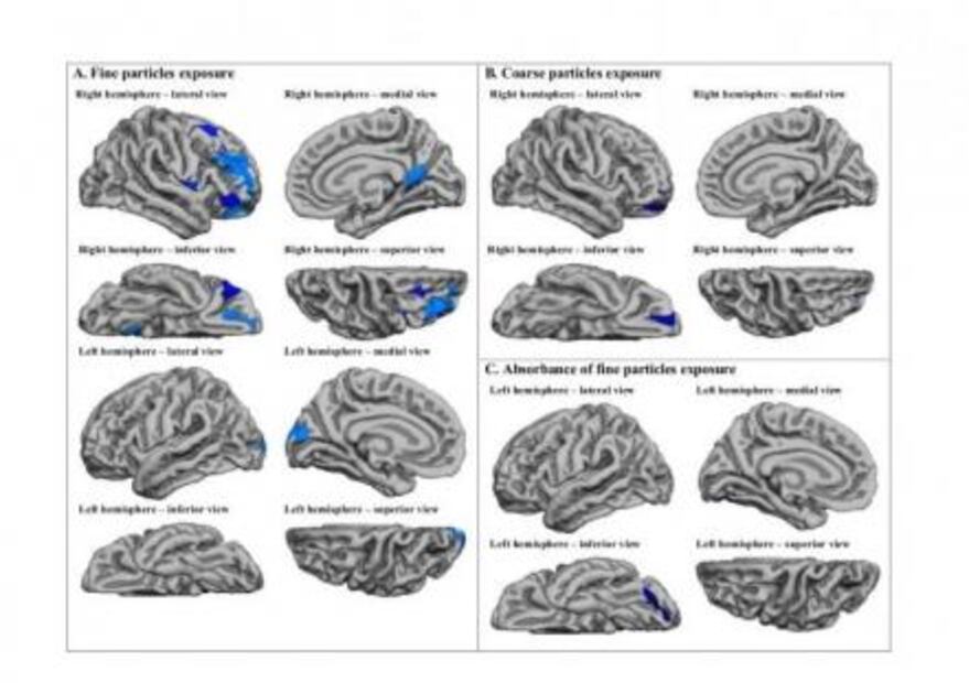 La contaminación altera el cerebro de las mujeres embarazadas