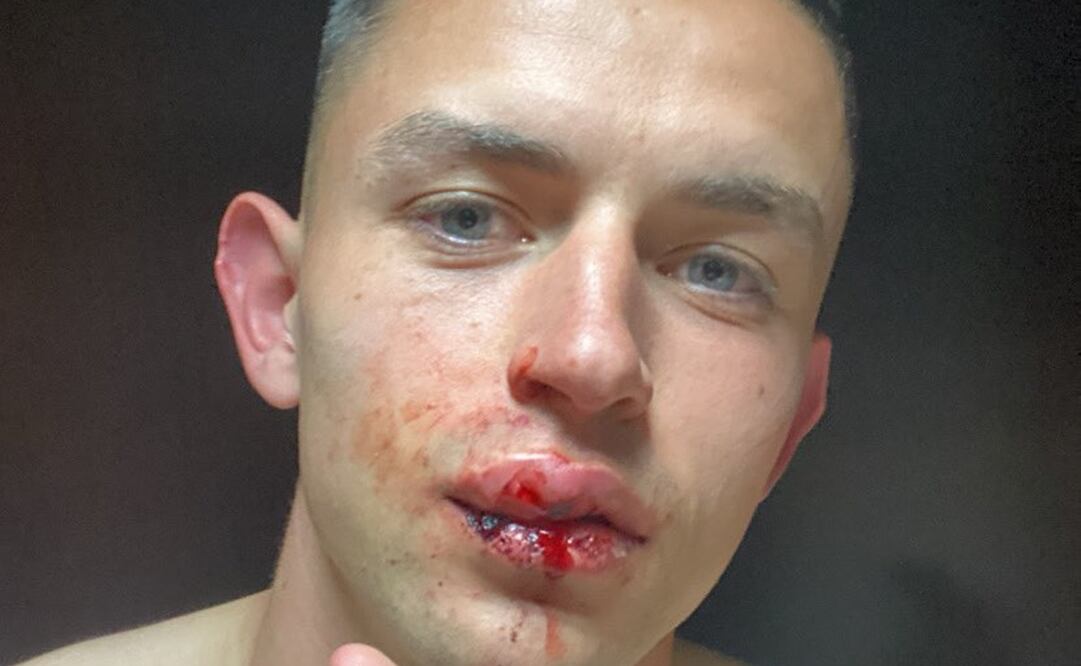 FOTO: @Alvaro10fidalgo