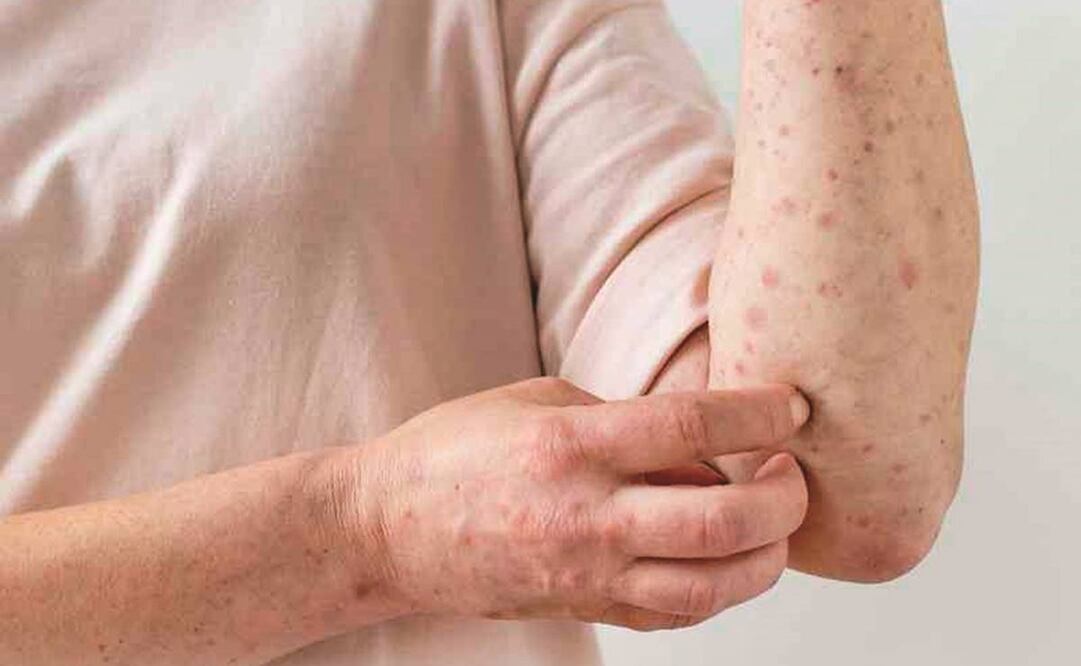 Foto: Archivo EL UNIVERSAL 