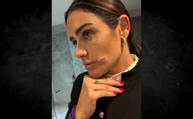 "La violencia no se negocia, no se justifica, no se aplaude": Alessandra Rojo de la Vega tras agresión en Zona Rosa