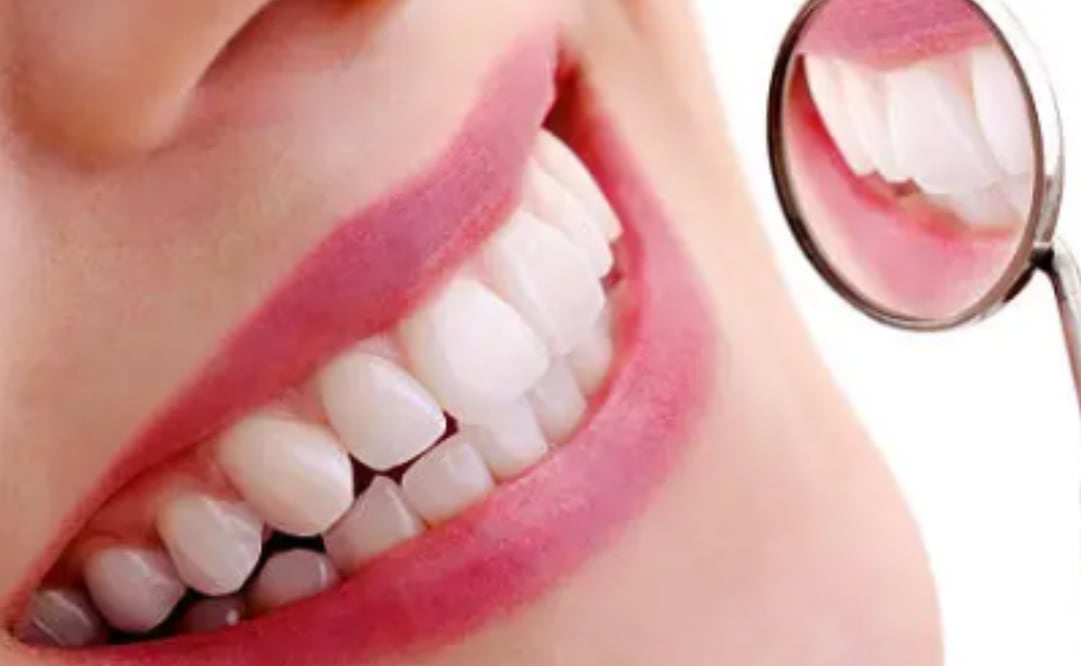 El durazno ayuda a mantener los dientes sanos. Foto: Pixabay