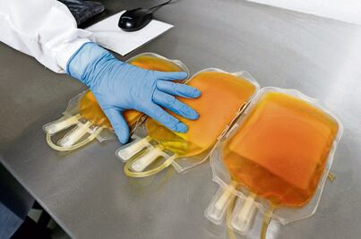 El plasma convaleciente no tiene beneficios significativos frente al Covid-19, sugiere nuevo estudio