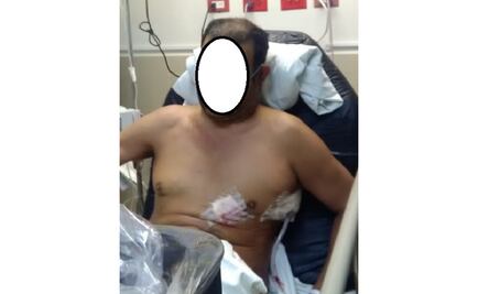 Hombre se lesiona con su propia arma en Chihuahua