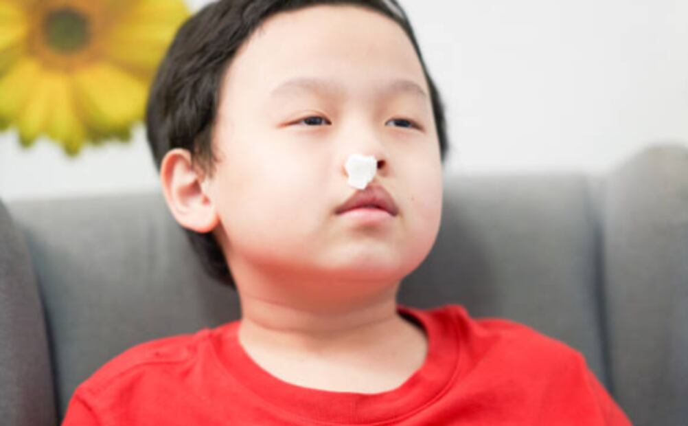 Epistaxis niño. Foto: Pixabay