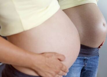 Nacen sin microcefalia bebés de madres con Zika en Yucatán