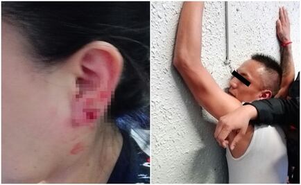 Ladrón desgarra oreja de usuaria del Metro para robarle aretes