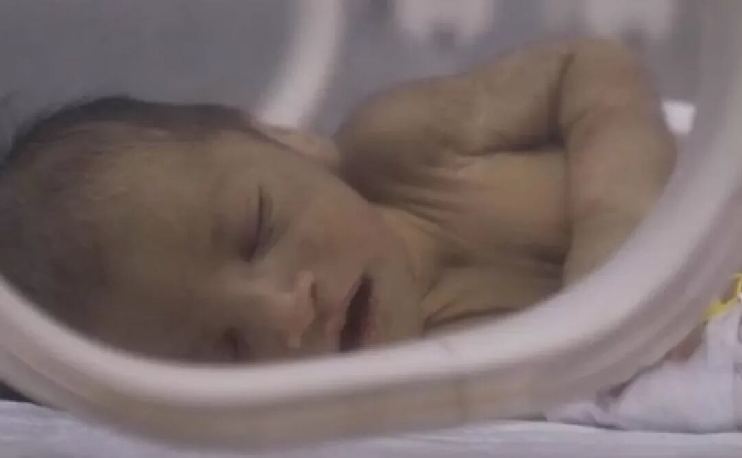 El pequeño Adnan en la incubadora del hospital de Afrin, en Siria. Foto: @SAMS_USA