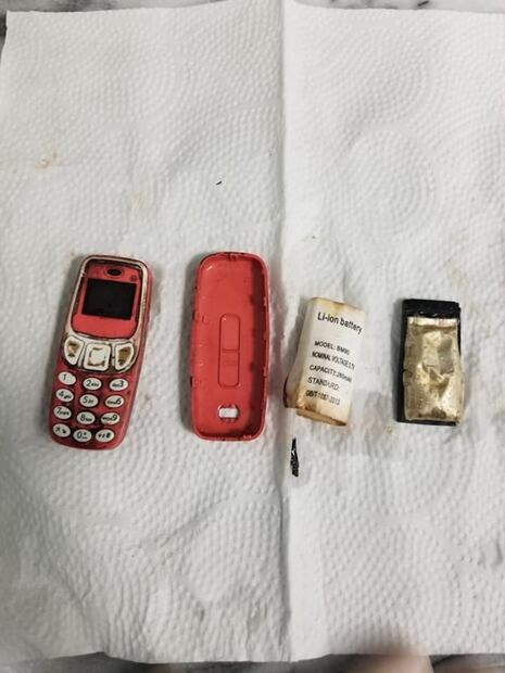 Viral: Hombre se traga un Nokia 3310 y termina en el hospital