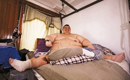Someten a segunda cirugía a hombre más obeso en Jalisco