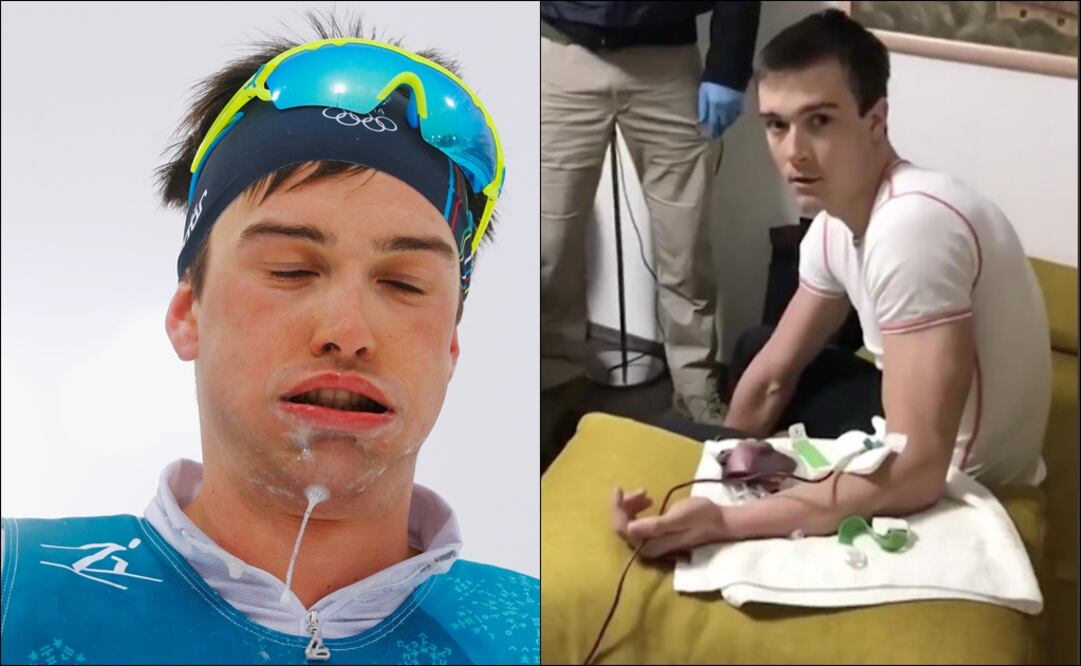 Max Hauke sorprendido en transfusión de sangre. Foto: Especial