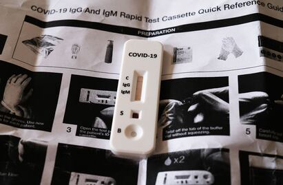 Covid-19. Pruebas caseras: ¿Dónde, a qué precio y cómo realizarlas?