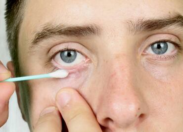 Esta enfermedad puede causar ácaros en las pestañas