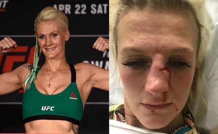 Peleadora de MMA recibe brutal golpiza de su pareja