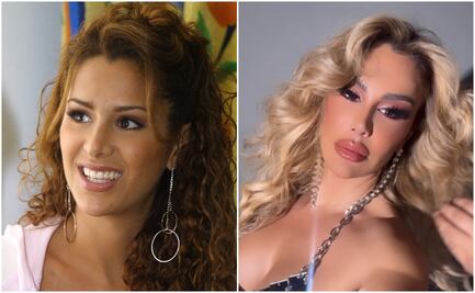 Ninel Conde presume labios voluptuosos y desata las críticas