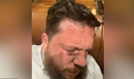 Aliado de Navalny acusa a Putin de brutal ataque en su contra en Lituania