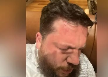 Aliado de Navalny acusa a Putin de brutal ataque en su contra en Lituania