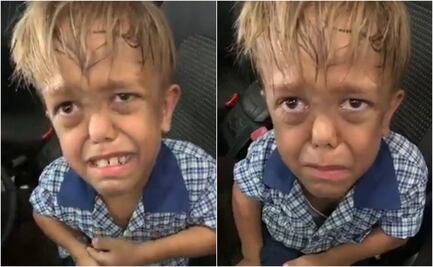 De sufrir bullying por su enfermedad a triunfar en Hollywood; esta es la historia de Quaden Bayles