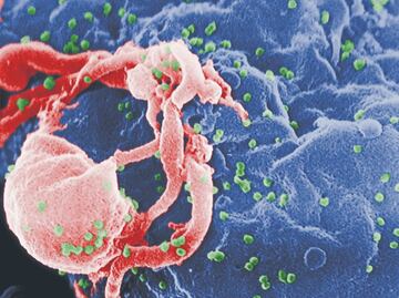 El VIH, causante del Sida: uno de los azotes de la humanidad