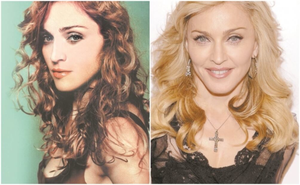 Famosos que recurren a la cirugía estética para ser mejores