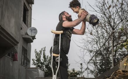 Foto de niño sirio sin brazos ni piernas conmueve en Italia; lo ayudan a recaudar fondos