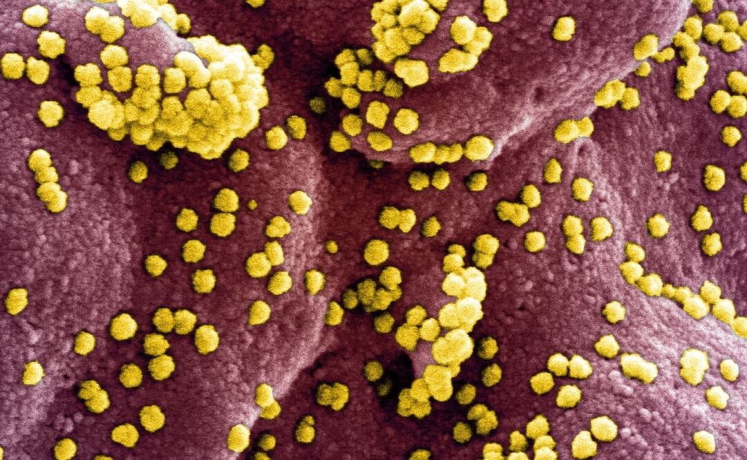 Foto: EFE/EPA/NIAID/NATIONAL INSTITUTES OF HEALTH 