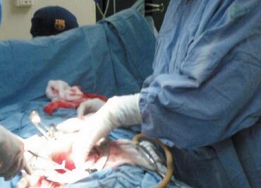 Más de 15 mil personas esperan un nuevo riñón