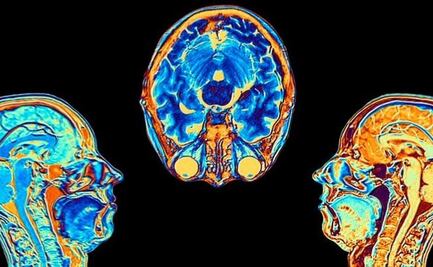 Día Mundial del Cerebro 2022: Los daños que provoca el Covid-19