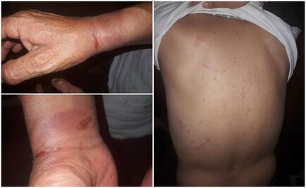 Golpean a taxista de la tercera edad para robarle auto en Chalco