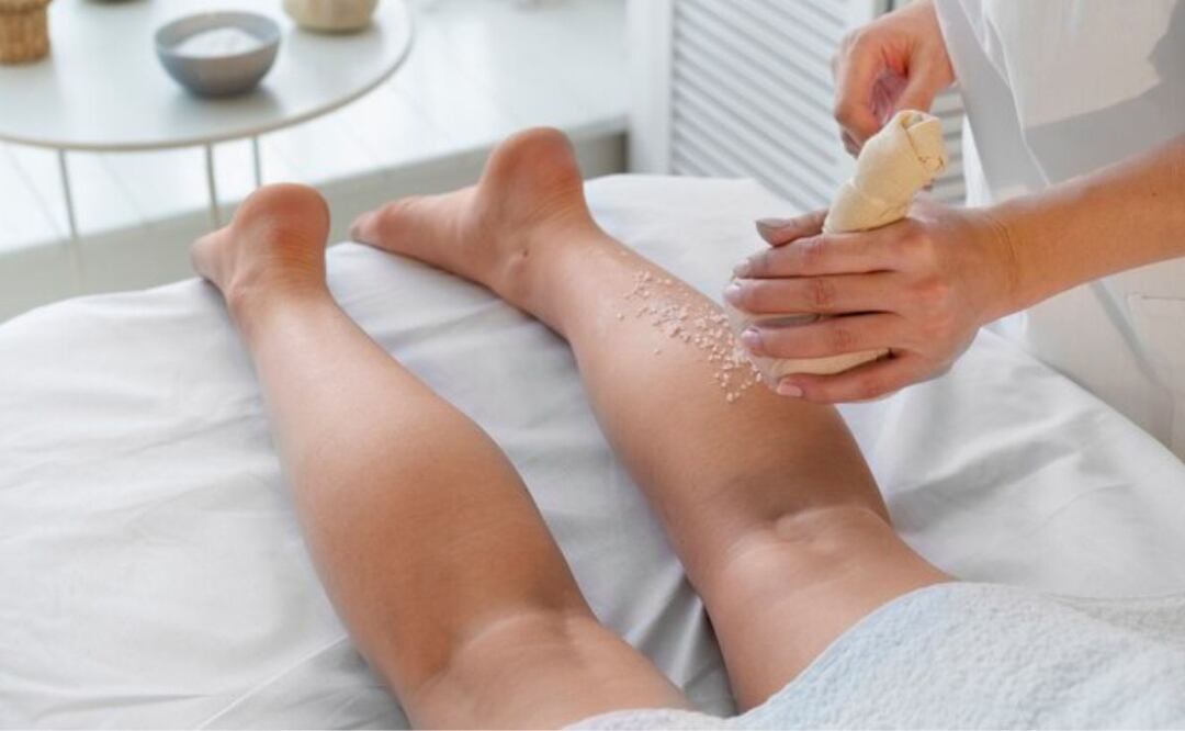 Alimentación contra las várices. Fuente: Freepik