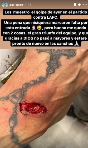 Alan Pulido muestra la brutal cortada que le dejó el pisotón de un rival