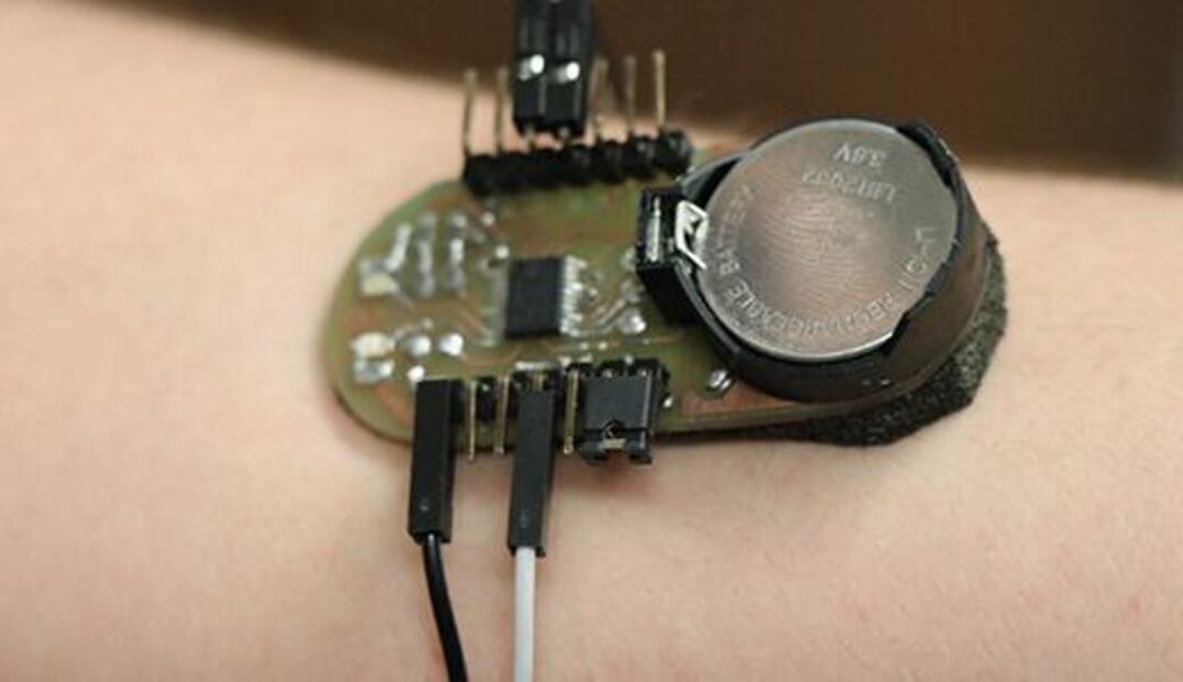 Desarrollan pulsera para medir la glucosa en la sangre en Morelia