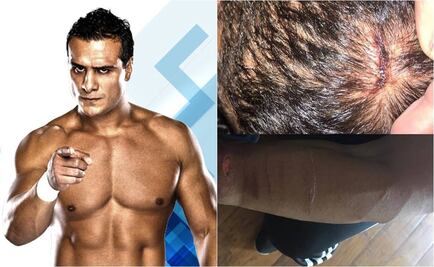 Alberto del Río, herido “por un criminal con una navaja”