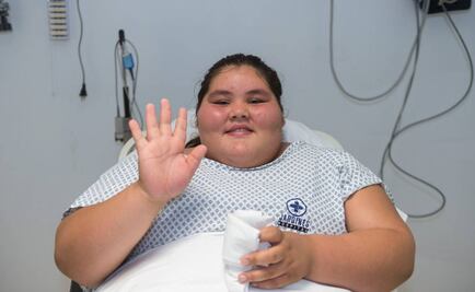 Dan de alta a adolescente sometida a bypass gástrico