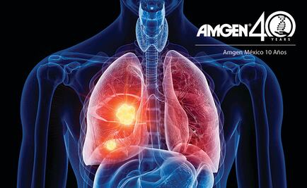 La importancia de los Biomarcadores en Cáncer de pulmón