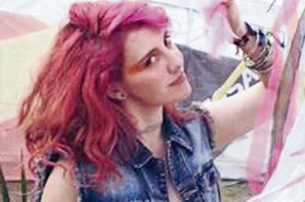 Barra cuda , vocalista del grupo Jot Dog, acompañó su testimonio con una imagen en la que se aprecia un moretón en su brazo (FOTOS TOMADAS DE FACEBOOK)