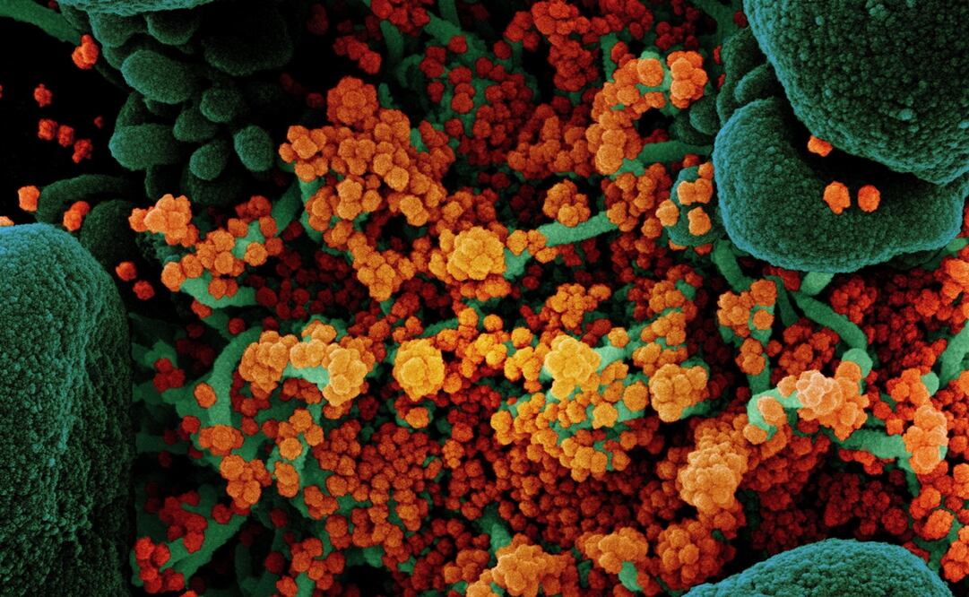 Foto: EFE/EPA/NIAID/NATIONAL INSTITUTES OF HEALTH