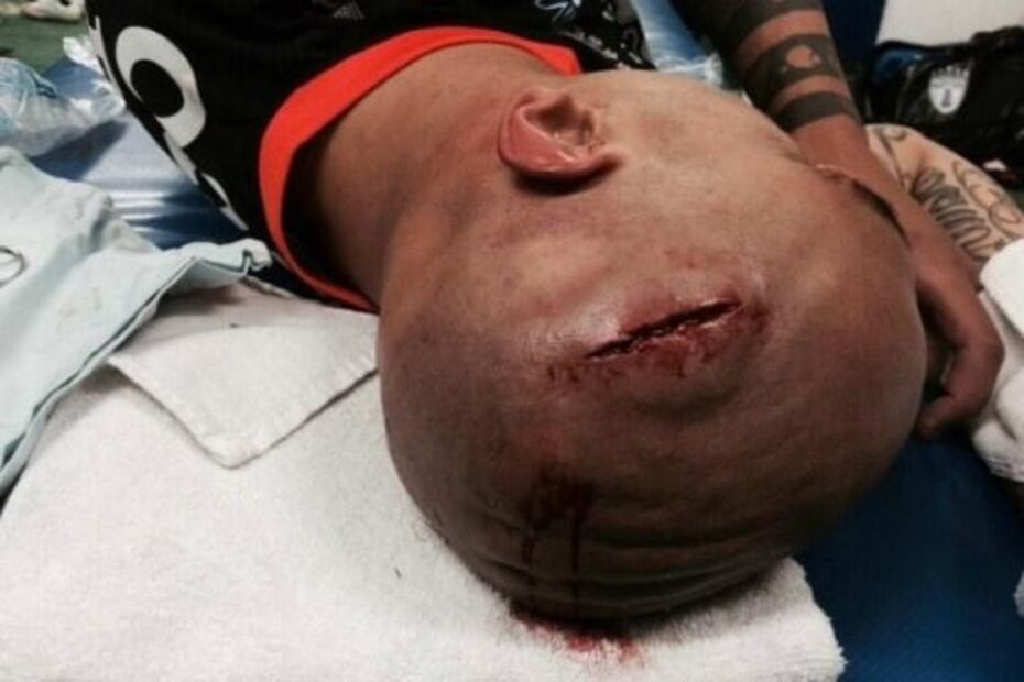 Las peores heridas por arteras entradas en el futbol