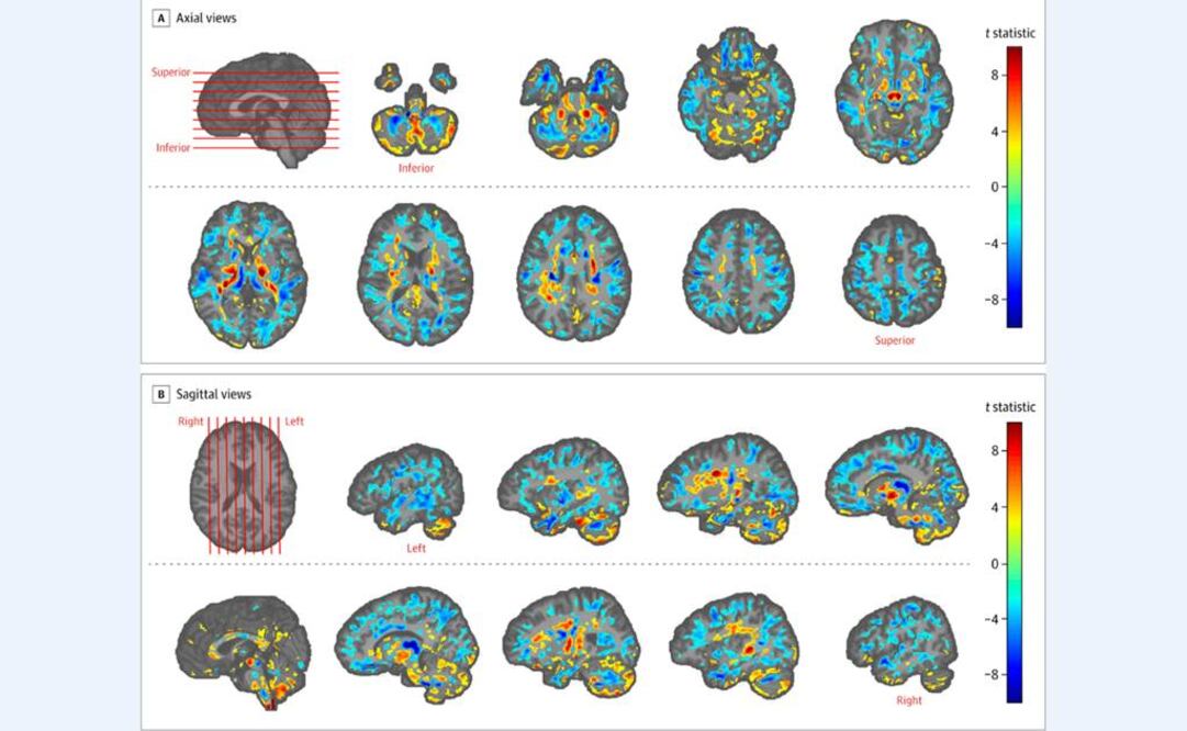 (Asociación Médica de EU vía AP)