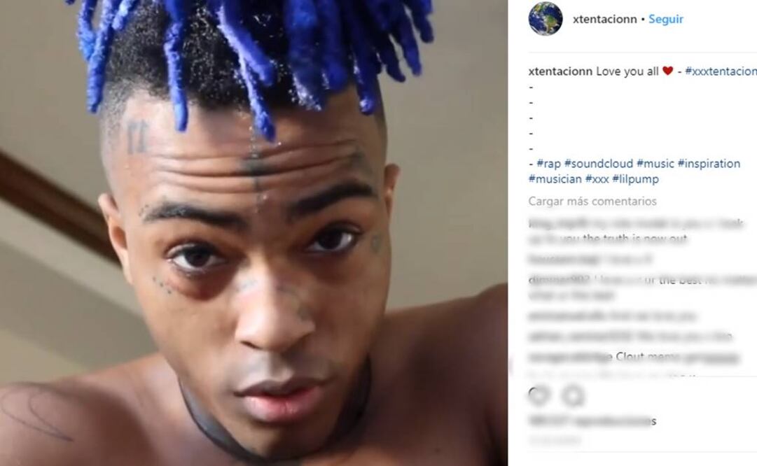 XXXTentacion fue baleado FOTO: INSTAGRAM