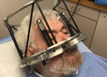 Me hicieron un implante cerebral para controlar mi adicción al alcohol