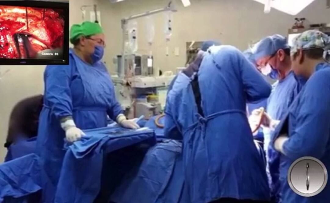 Médicos del ISSSTE extraen con éxito un tumor cerebral complejo