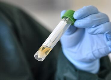 Descartan llegada de la variante ómicron a Sinaloa