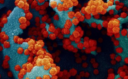 Variante del Covid-19 identificada en Brasil, ¿potencialmente peligrosa para la inmunidad?