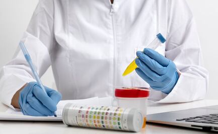 ¿Cómo debe ser el color de la orina de una embarazada?