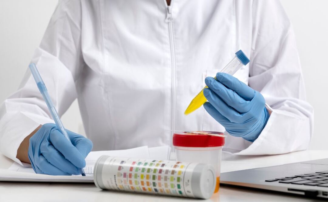 Orina en el embarazo. Fuente: Freepik