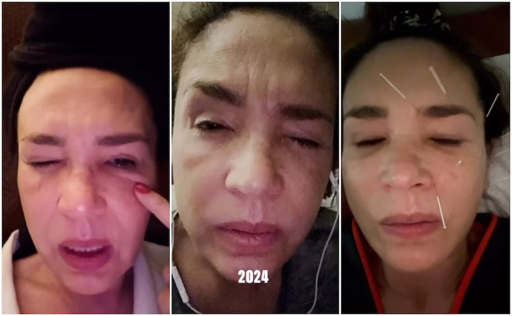 Yolanda Andrade muestra momentos de cómo la Esclerosis Lateral Amiotrófica ha afectado su rostro en distintos momentos desde 2023.